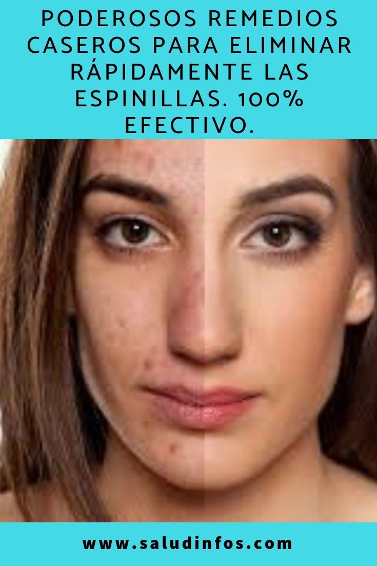 Como eliminar la afonia rapidamente