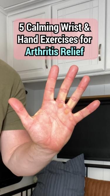 Top 5 Hand Exercises to Ease Osteoarthritis Pain