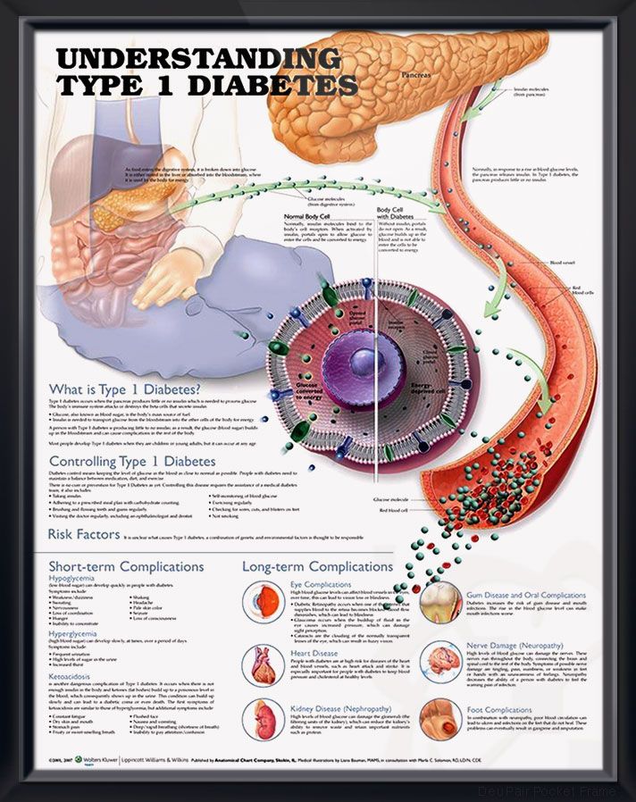 maladie cardiovasculaire prevención de diabetes