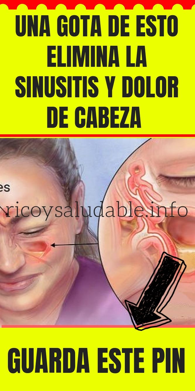 Una Gota De Esto Elimina La Sinusitis Dolor De Cabeza Y Otros Trastornos En Pocos Días Natural Medicine Sinusitis Health