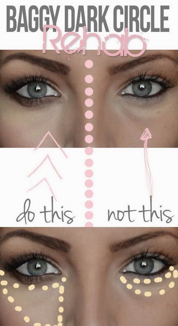 Can You Get Rid Of Eye Bags By Sleeping More Dark Circles Appear Under The Eyes Are Often Due To Fatigue Lack Of Sleep Can Damage Vision If These Dark Circles Eye Bags Treatment Eye Bags Eye Bags Makeup