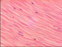 pix Dense Regular Connective Tissue Vs Smooth Muscle Histology dense regular connective tissue human
