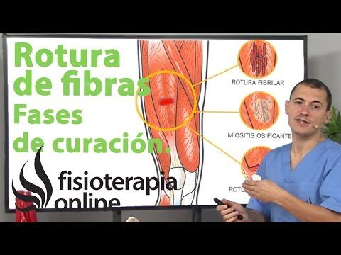 Como curar una rotura fibrilar en el gemelo