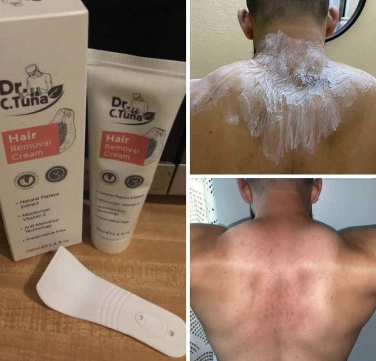 How To Remove Facial Hair At Home One Miracle Ingredient Diy Simpl Facial Hair Removal Cream Permanent Facial Hair Removal Hair Removal Permanent
