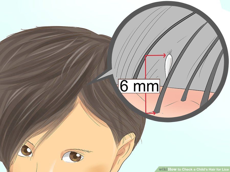 Pin By Lice Remover Kit On How To Prevent Lice Kids Hairstyles Lice pin-by-lice-remover-kit-on-how-to-prevent-lice-kids-hairstyles-lice