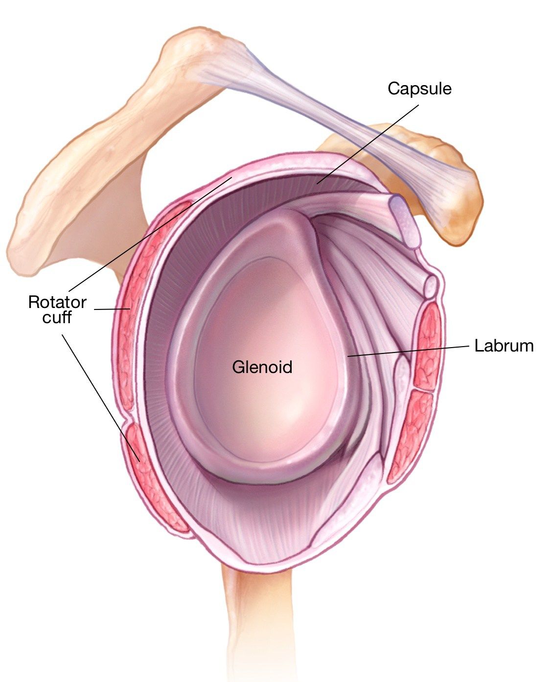 torn labrum of the shoulder causes symptoms treatment glenoid labrum tear
