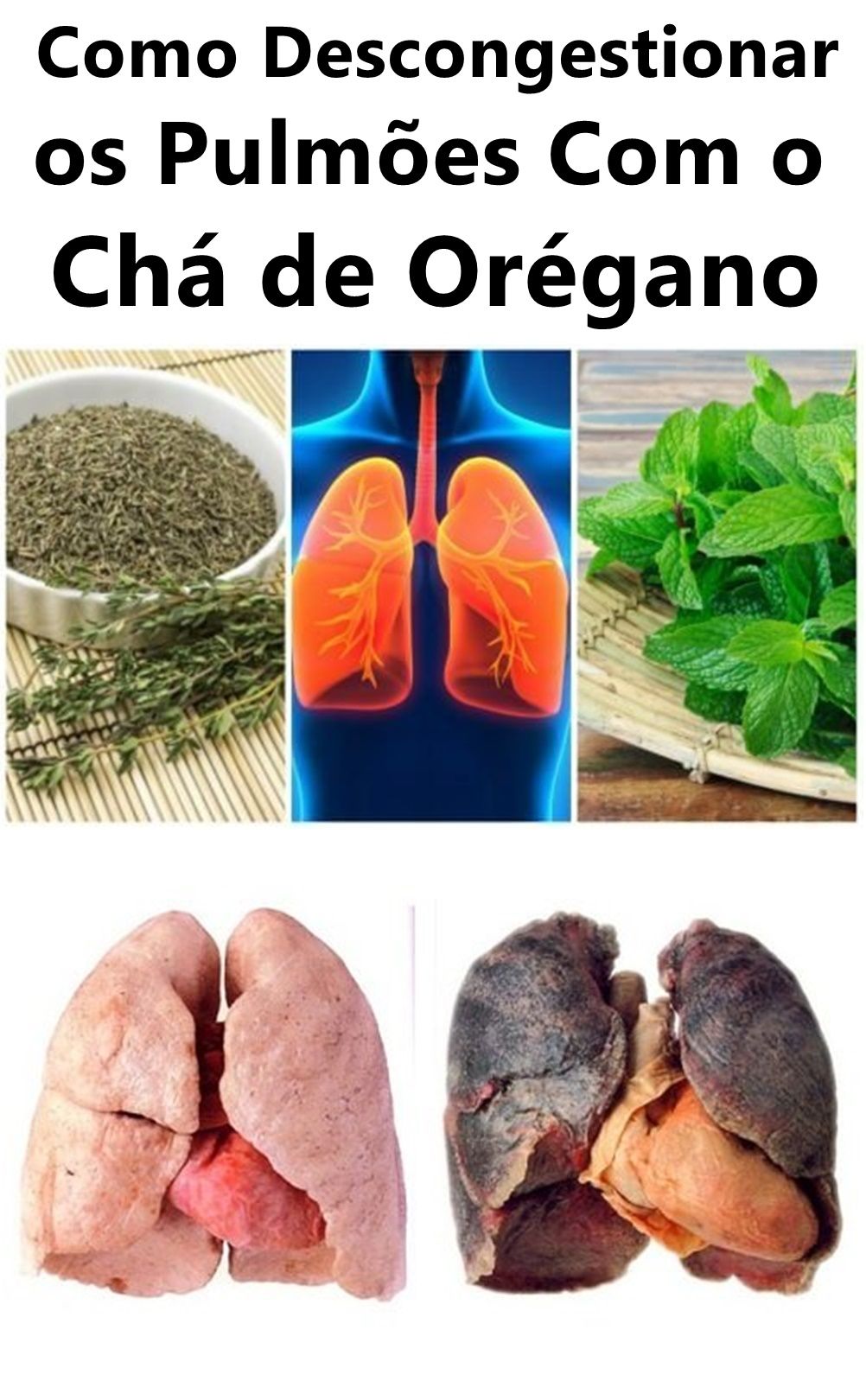 remedio caseiro para descongestionar o nariz sinusite