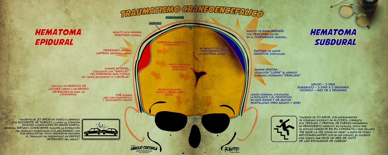 hematoma subdural agudo sintomas de diabetes