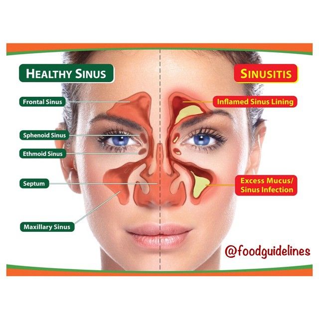 Chronic Fatigue Syndrome Treatment Natural Chronic Fatigue Syndrome Treatment Natural