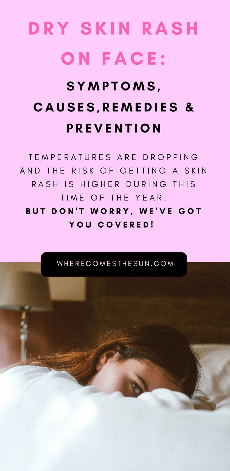 Stress: symptoms, causes, remedies Stress: symptoms, causes, remedies