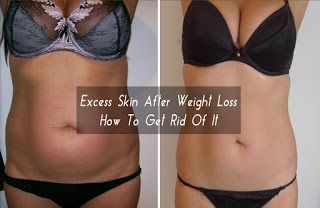 Lose fat burn muscle image 5