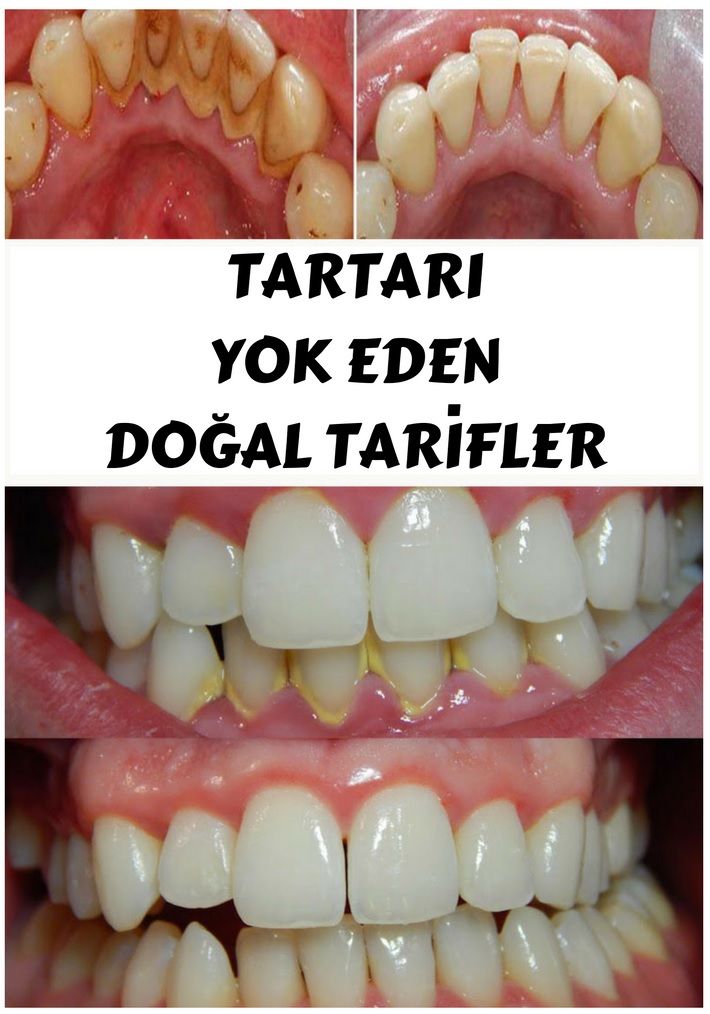 Sağlıklı beslenmek için nelere dikkat etmeliyiz kısaca ile Etiketlenen Konular Sağlıklı beslenmek için nelere dikkat etmeliyiz kısaca ile Etiketlenen Konular