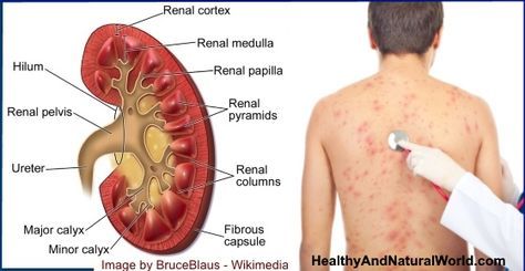 Foods Not To Eat After Liver Transplant Pinterest Foods Not To Eat After Liver Transplant Pinterest