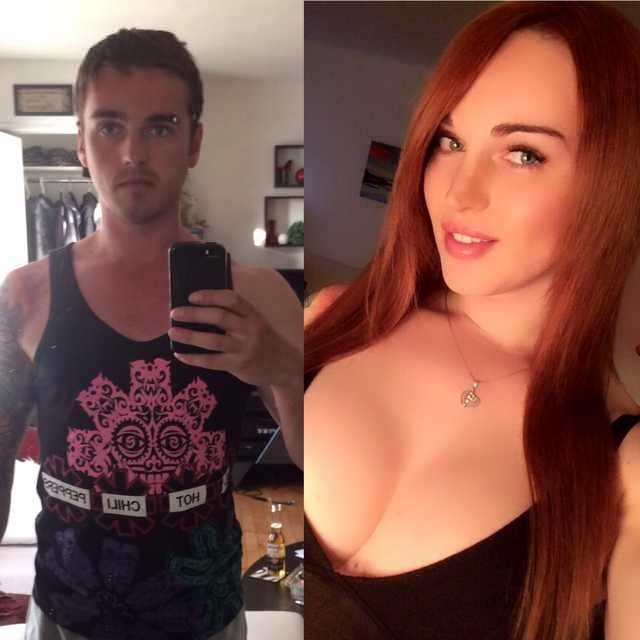 17 month HRT mtf 25 yo - Imgur Male To Female Transgender, Transgender Mtf,...