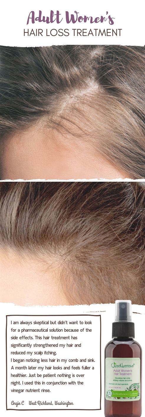 Finally Found The Best Hairmax Coupon Code 100 Off The Ultima 9 Laser Comb For Hair Loss This Was On My Wishlist For A Long Light Therapy Laser Comb Laser