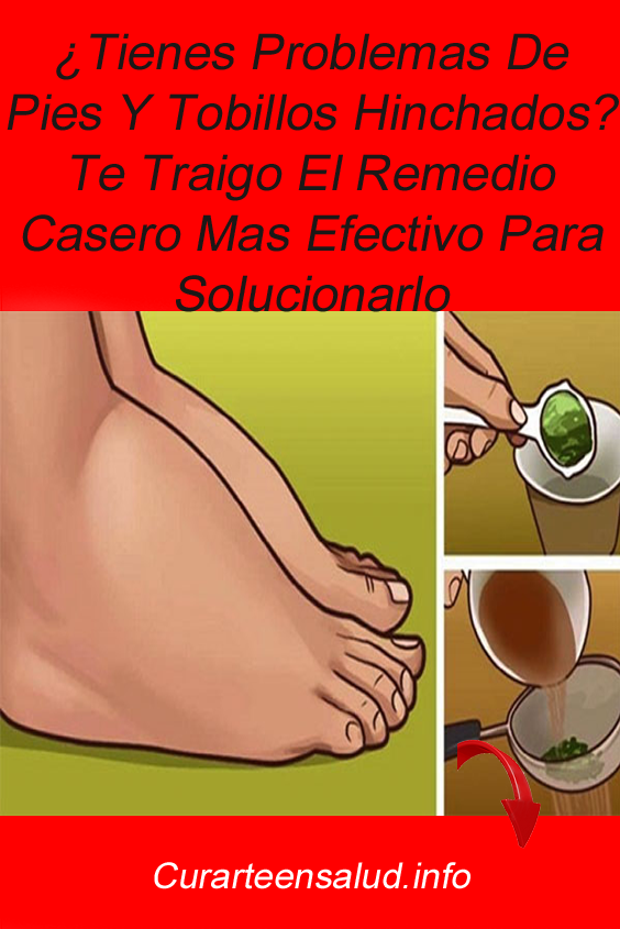 remedios para adelgazar tobillos remedios para adelgazar tobillos