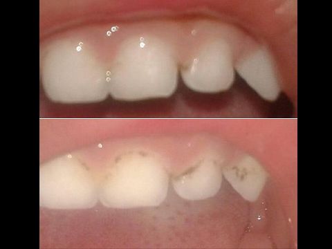 جربت عشبة فسنينات خويا الصغير و حيدات ليه السوسة فالبلاصة