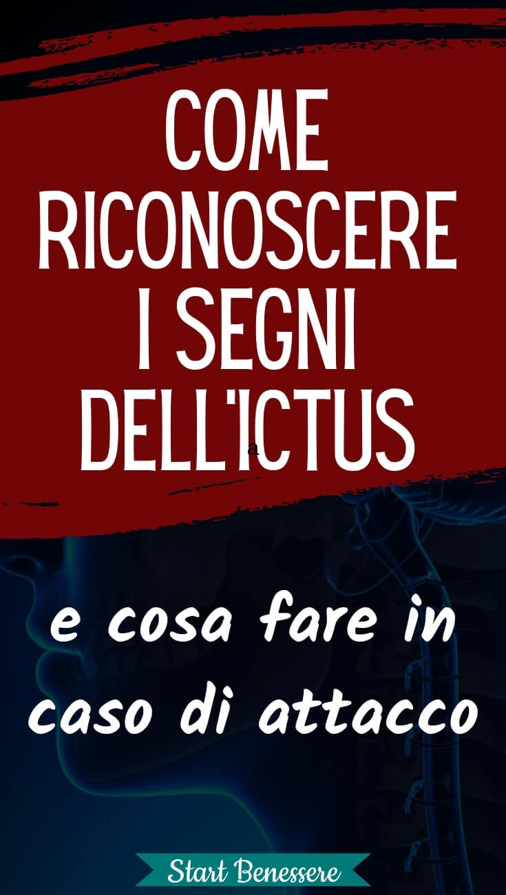 perdita di peso dellictus