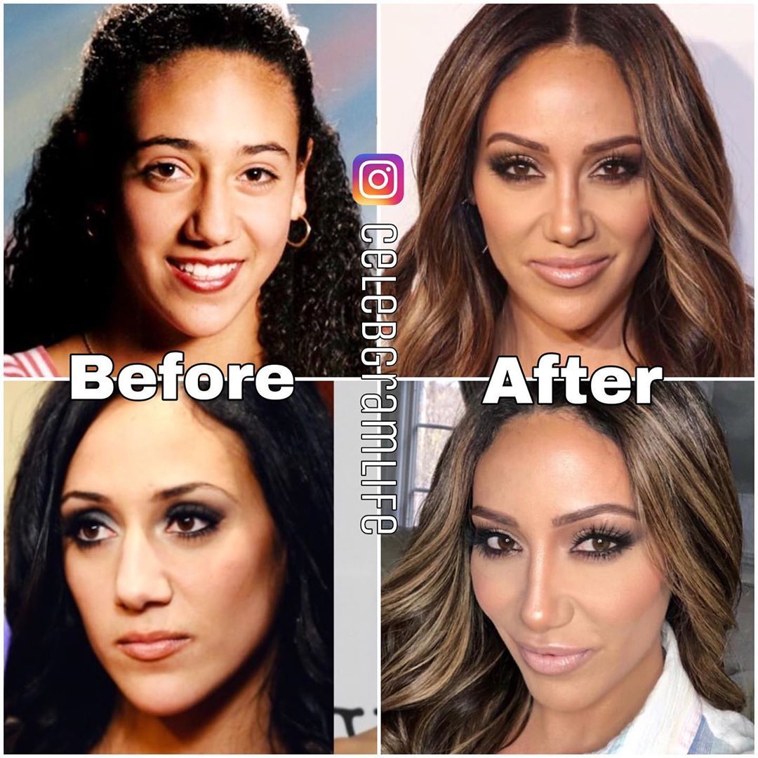 C E L E B G R A M L I F E 🔥 on Instagram: “Melissa Gorga before and