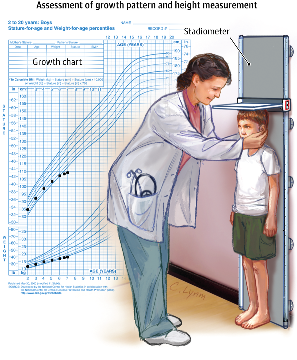 Short Stature. JAMA. 2014;311(17):1822. doi:10.1001/jama.2014.1874. Pediatric Medicine, Science Notes, Jama, Nursing Tips, Thyroid Hormone, Growth Hormone, Chronic Disease, Medical Information, Pediatrician