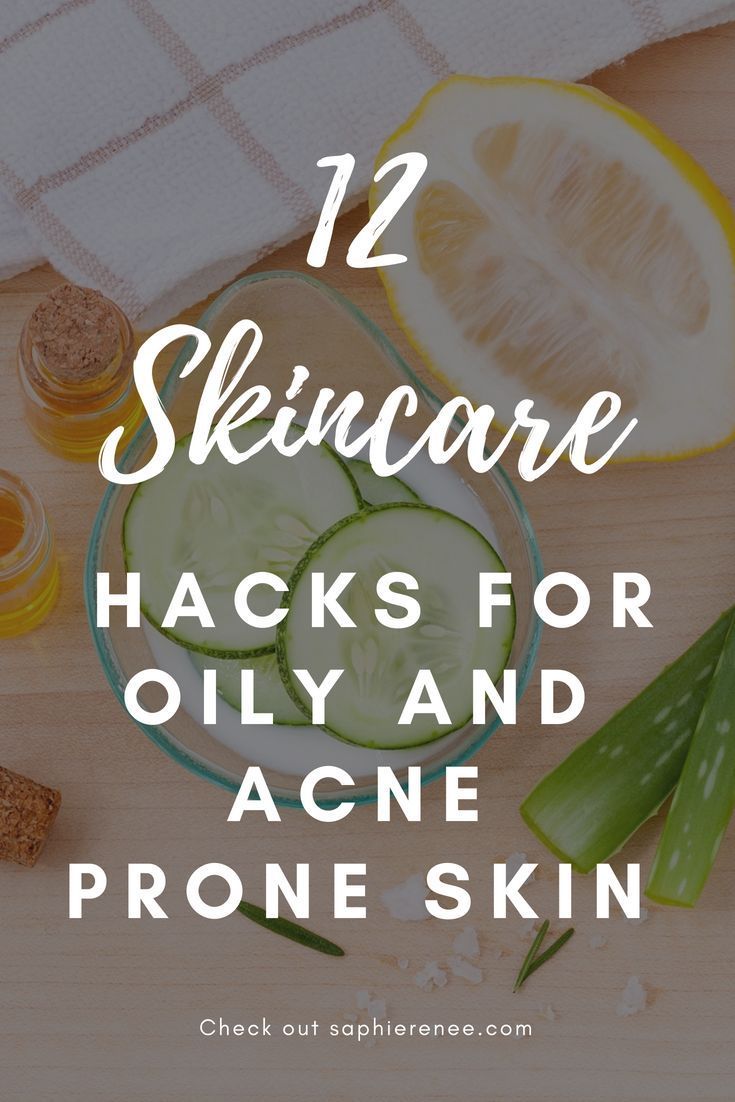 12 Skincare Hacks for Oily and Acne Prone Skin | Acne
