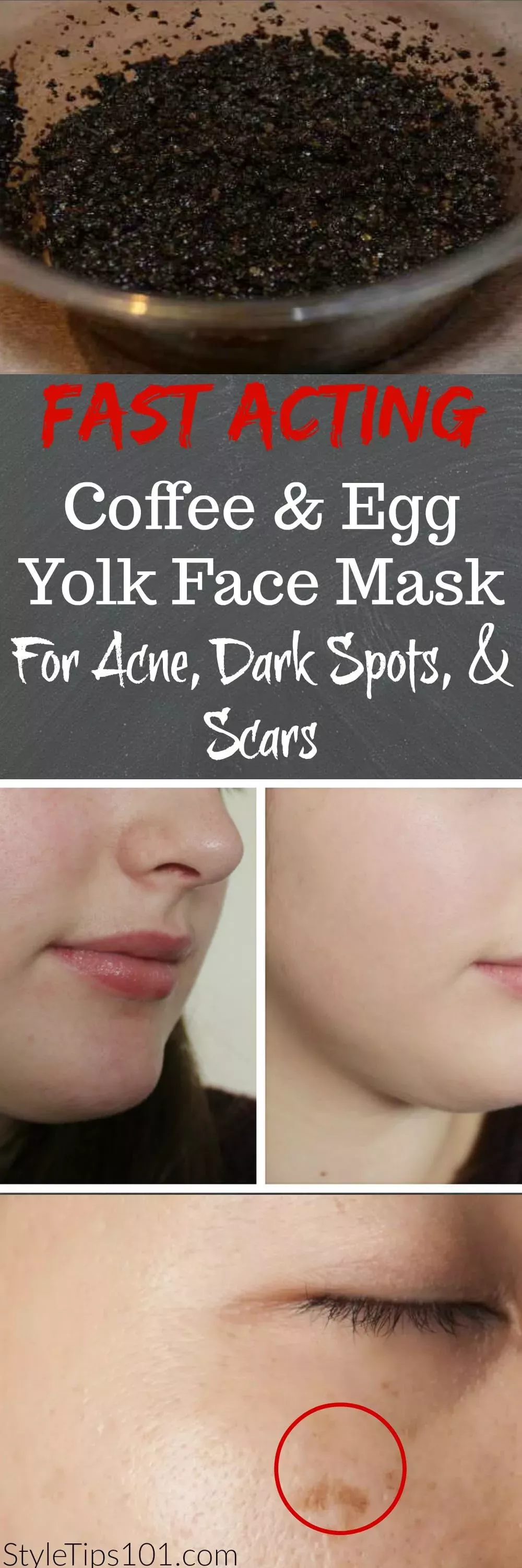 Enjoyable Dark Skin Beauty Tips Enjoyable Dark Skin Beauty Tips