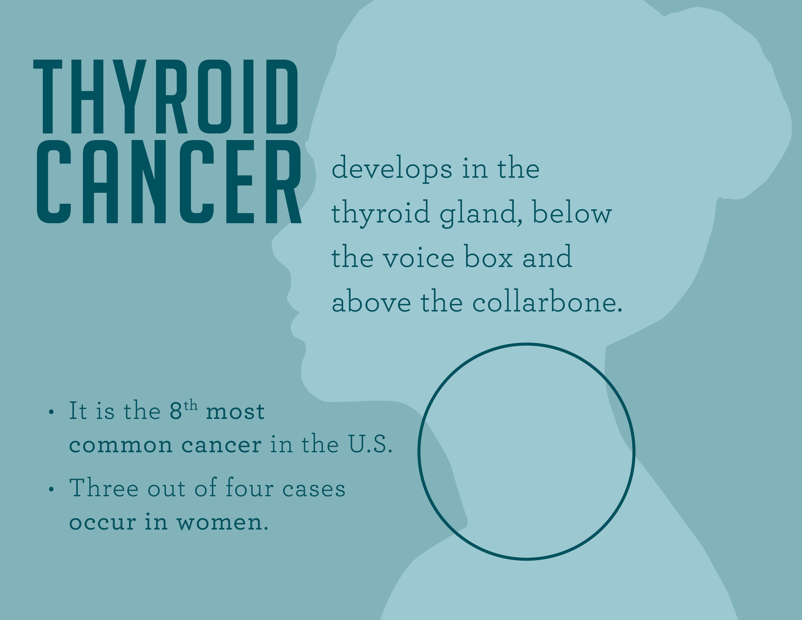The main symptom of thyroid cancer The main symptom of thyroid cancer
